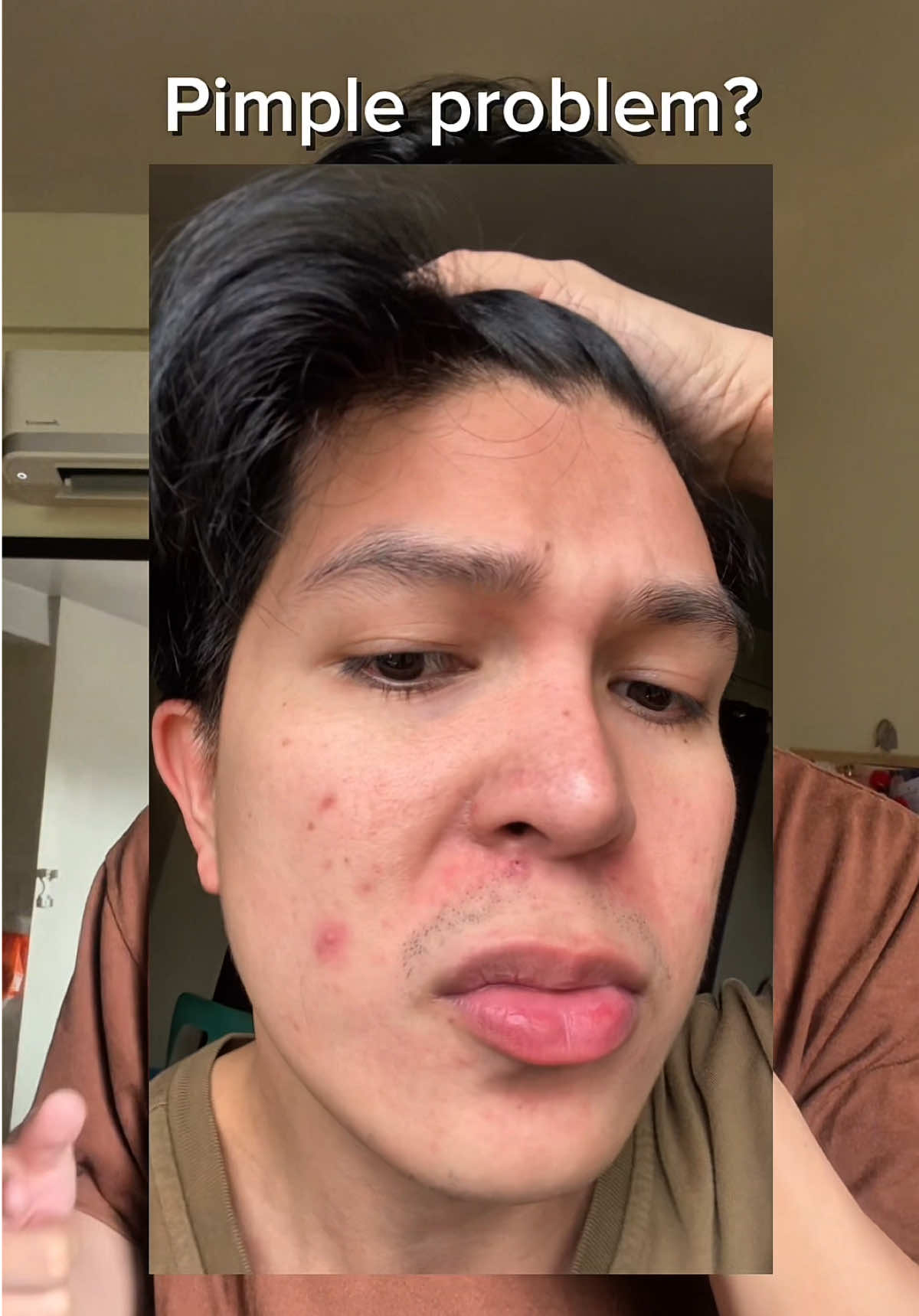 Grabe hiyang ko sa product nato  @NUVI #NUVI #Acne #Skincare #NUVIASIA and the yellow basket.