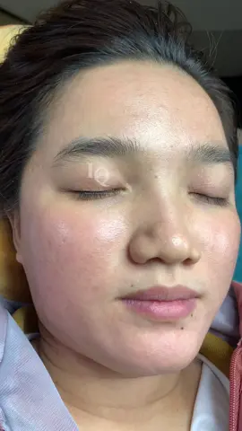 Cập nhật Mụn Thâm#nanmunbangtambong#chamsocdaseo#chamsocda#chamsocdamun#chamsocdanam     