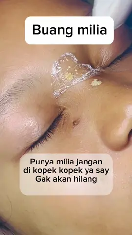 Buang milia #buangmilia #buangmilialubukbasung #buangfleklubukbasung #buangtahilalatlubukbasung #buangtahilalatpariaman