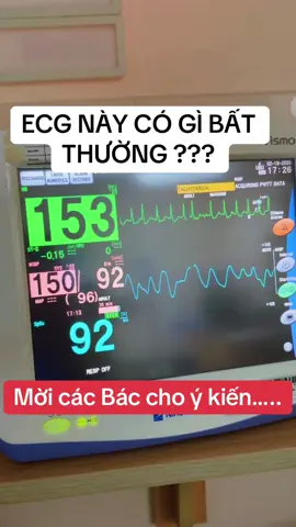 Bệnh nhân nam, 70 tuổi, vào viện vì khó thở do COPD (bệnh phổi tắc nghẽn mạn tính…) #drhieu #ecg #health #doctor #smoke 