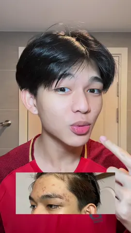 สภาพหน้า#fyppppppppppppppppppppppp 