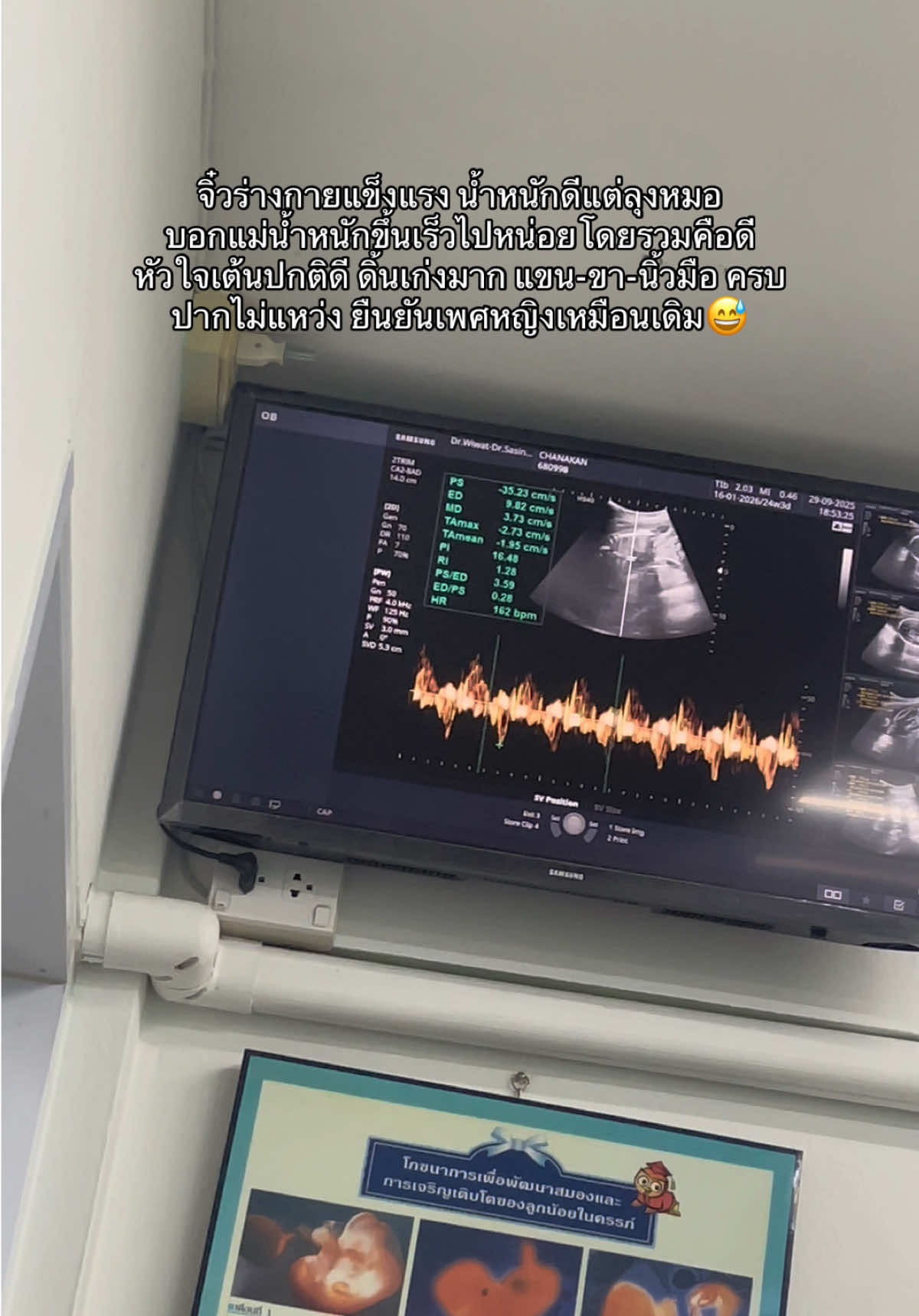 #อัลตาร์ซาวด์ #ลูกสาวคนแรก #ทีมมกราคม69 