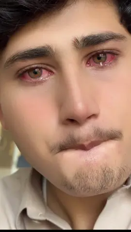 Yar marawar shaw da zar me parhar shaw da…#viral_video #foryou #Plz #mardanking #Plz #Love #Yarano #Plz #foryou #foryou #viral_video #Plz #foryou #Plz #Plz #Love #Yarano #mardanking #myviralvideo #Plz #Plz #foryou #foryou #viral_video #Plz #Yarano #viral_video #Plz #foryou #viral_video #Plz #mardanking #Plz #Plz #foryou #viral_video #viral_video #Plz #foryou #Yarano #viral_video #viral_video #viral_video #foryou #foryou #plz👈 😭😭😭