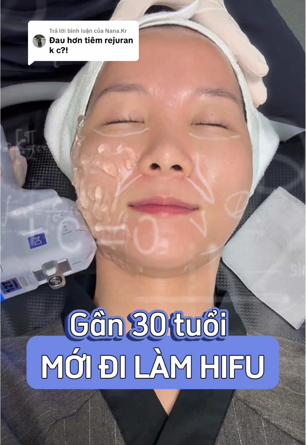 Trả lời @Nana.Kr có đau không, có sưng không, 1 liệu trình hifu của mình gồm những gì và video này chính là câu trả lời nha! #hifu #nangco #trehoa #review #fyp 