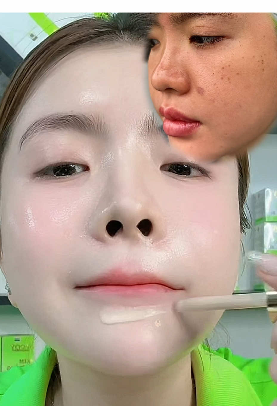 Tinh chất peel da hút sắc tố nám mụn tàn nhang và trẻ hoá da