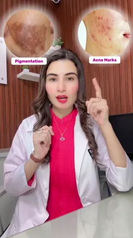 Whitening Serum | @skindrops.pk ™ #skincare #skincareroutine #viral #fyp #fypシ゚ 