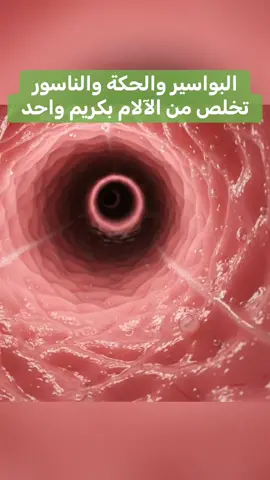 #healthy #بواسير_خارجية #بواسير_داخلية #الناسور_الشرجي #الناسور_العصعصي #fyp #fyp #الناسور #اكسبلور #صحة_عامة #الشعب_الصيني_ماله_حل😂😂 #life #اكسبلورexplore❥🕊 #بواسير #مرض #شرح #نصائح 