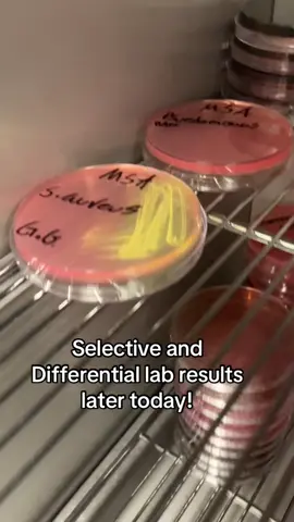 Microbiology lab today! #Science #microbiology #lab #scienceexperiments #bacteria 