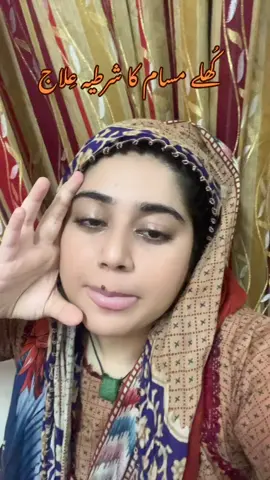 How to get rid of open pores….. ….@beenishali286 #beeashbeauty #skincare #whitening #fypシ #fyp 