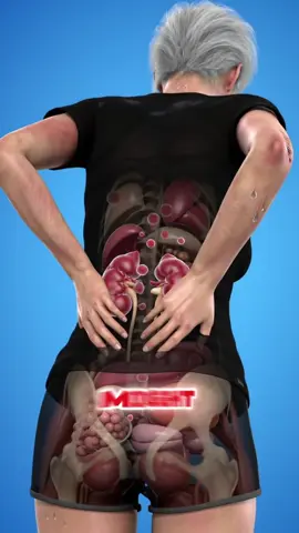 Six signs you might have kidney failure and your body warned you one month in advance #kidneyfailure #kidneydisease #kidney #healthtip #usa 
