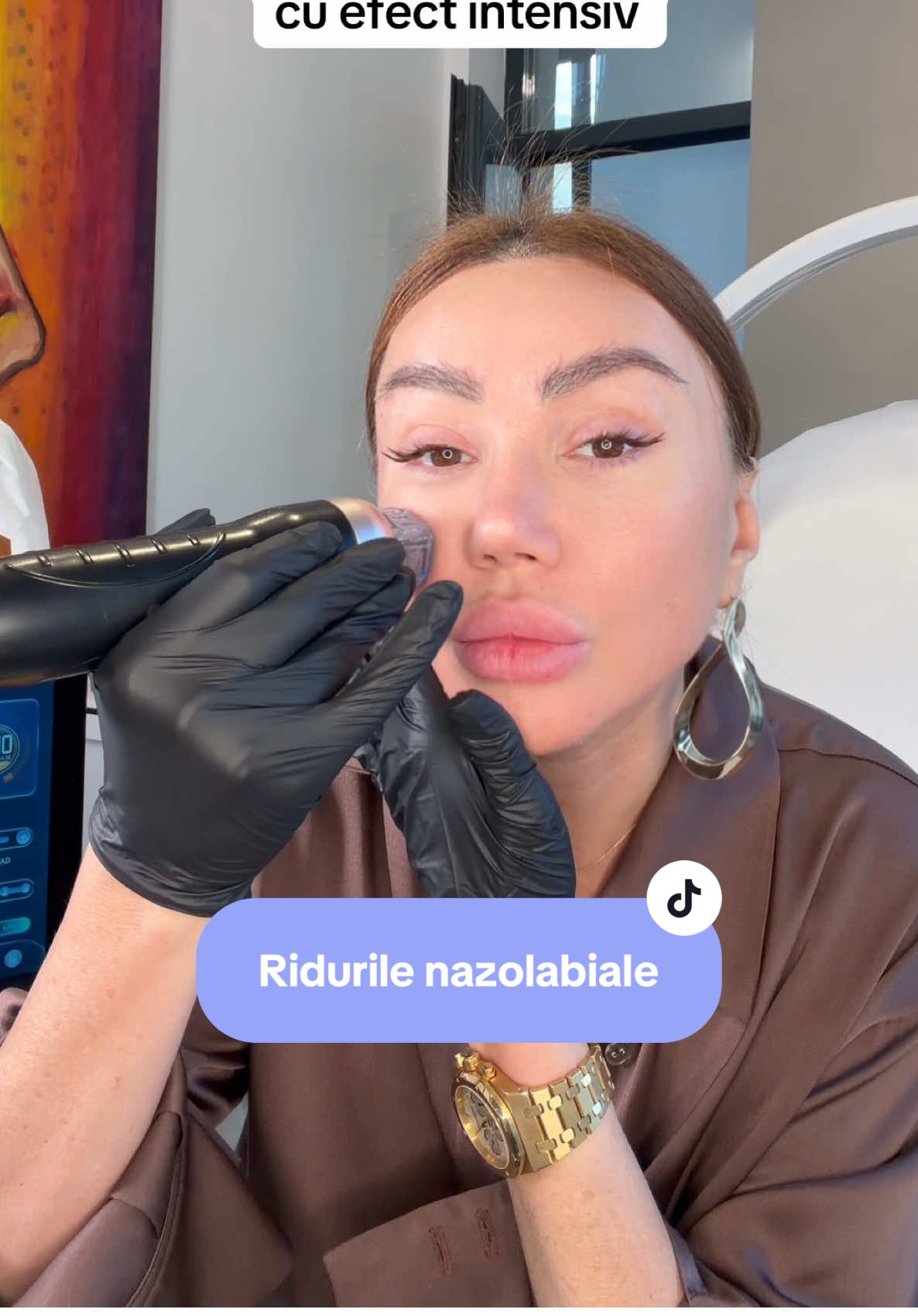 Ți-am pregătit un protocol avansat, non-invaziv, care combină trei tehnologii puternice, cu efect intensiv: peeling cu acid mandelic pentru retexturare și stimularea colagenului, peptide cu efect botox-like pentru relaxarea liniilor fine fără injectare și fără toxină, ambele potențate de micro-needling RF, pentru regenerare profundă și efect de lifting nechirurgical! #wrinkles #antiaging #peeling #microneedling #CerealCerdik 