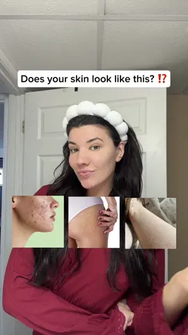 Your skin is CRAVING beef tallow 🙌🏼 for all my girls looking for CLEAN & NATURAL skincare — this is it!  #PureGoodTallow #PureGoodSkincare #NonToxicSkincare #SkincareMadeForEveryBody #CleanBeauty 