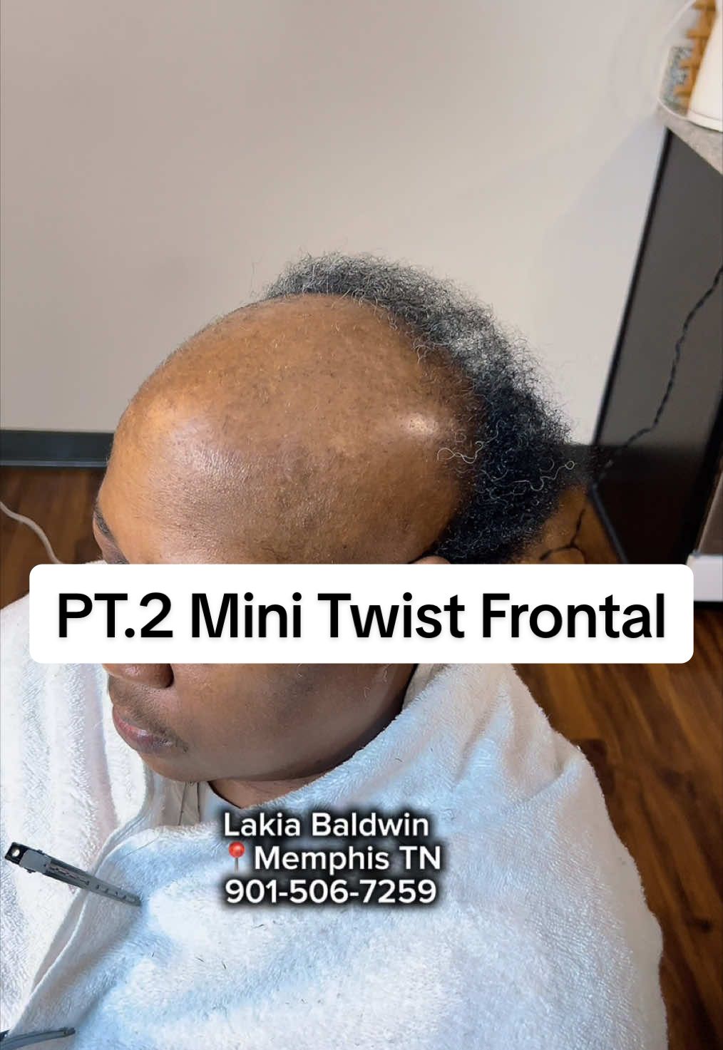 PT. 2 Mini Twist Frontal 🤯🔥💗 #Twist #Hairloss #Alopecia #Coverup #creatorsearchinsights #cosmetologist #HairLossHelper #Confidence #Makeover 