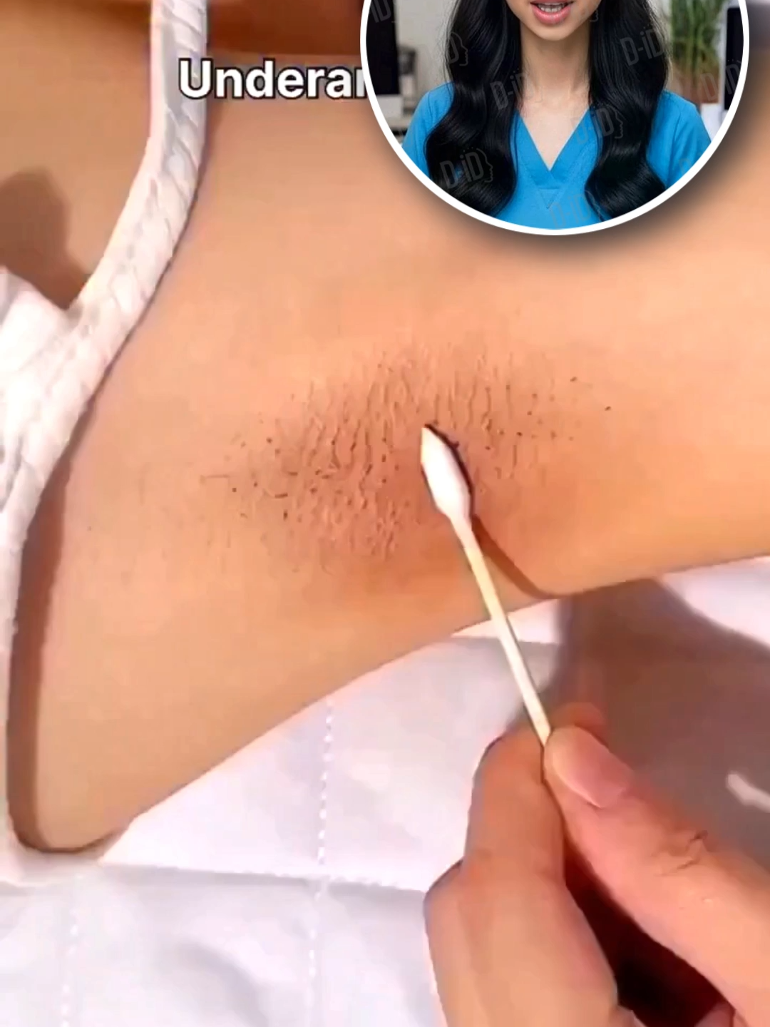 বগলের কালো দাগ ও লোম দূর করার ঘরোয়া ম্যাজিক ফর্মুলা