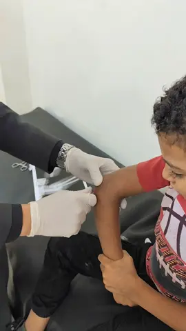 رفع اسلاك من الكوع بعد لحام الكسر  #دكتور_إيهاب_جعفر  #fyp 