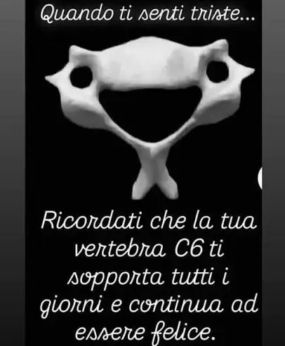La vertebra cervicale è famosa e facilmente riconoscibile per essere “felice”, inoltre è l’ultima vertebra cervicale che presenta un processo spinoso bifido #medstudent #anatomia 