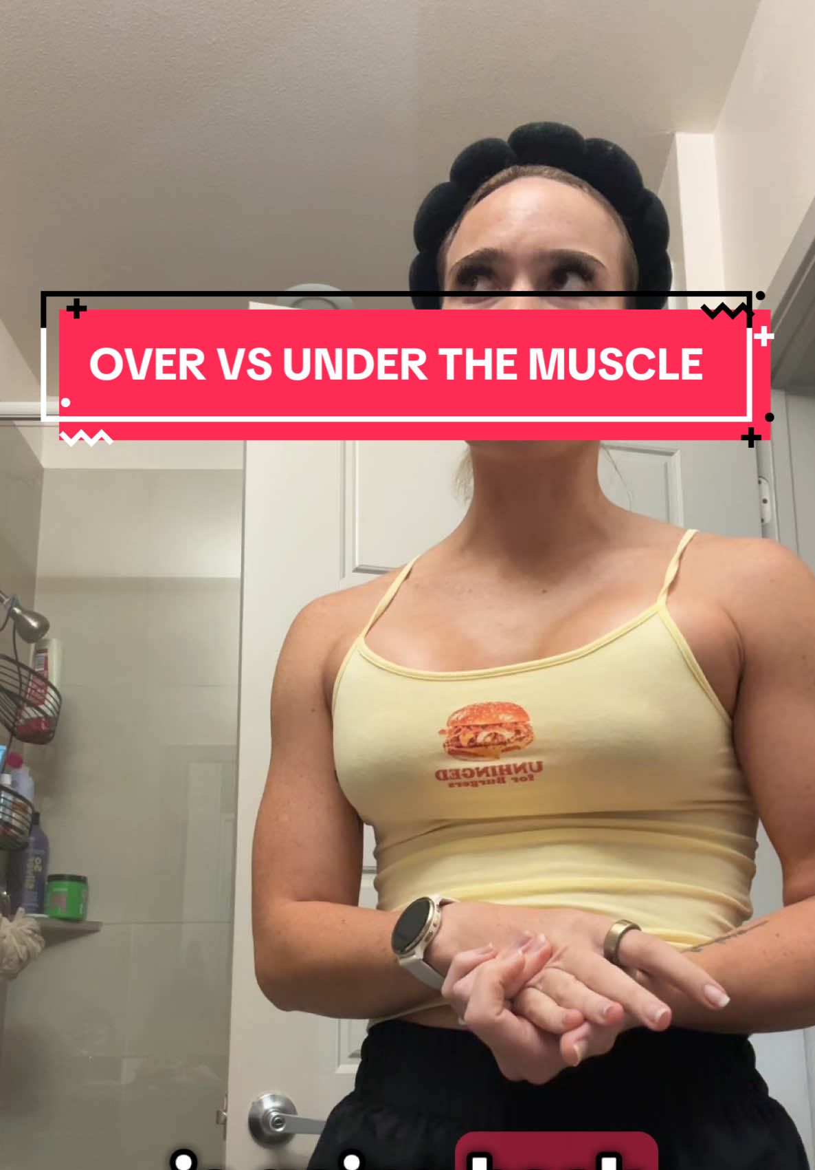 Replying to @Heather Brown6359 also important to remember i didn’t have much breast tissue before !! so OTM might be a better option for someone that already has tissue!!  #breastaugmentation #breastaug #overvsundermuscle 