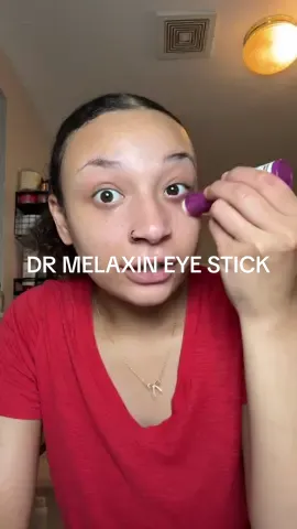 No I’m not sick or tired I just have dark baggage 😩😭 but no worries, this bad boy is about to clear it all up! 💕 #drmelaxin #eyebags #darkcircles 