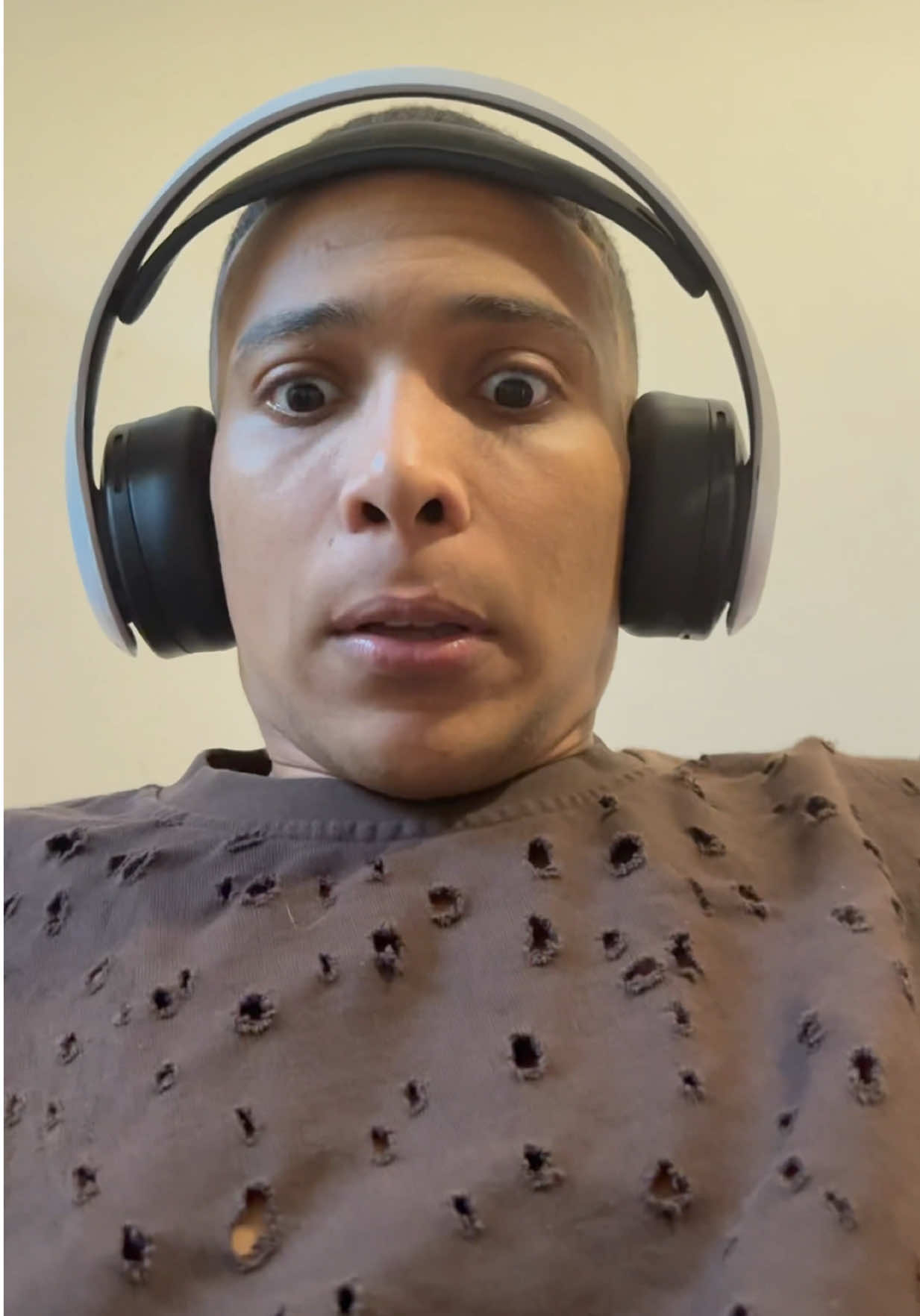 Ora ha un bernoccolo 