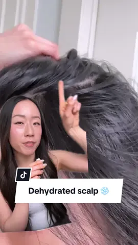 🧪 A flaky scalp is the worst, especially if you have dark hair like me because it looks even more obvious. Regularly exfoliating my scalp kept my flakes away, but I noticed that sometimes I would still see smaller sized flakes. After doing some research, I realized these smaller flakes were not dandruff, but a sign of a dehydrated scalp. And it makes so much sense - I regularly use both physical and chemical exfoliants on my scalp in addition to shampoo, but I never use a hydrating leave on product! Our scalp is skin too, so of course it would be dry. Luckily, there are now plenty of scalp serums from the market to choose from. I’ve been loving using the Natural Moisturizing Factors + Hyaluronic Scalp Serum from @The Ordinary after washing and drying my hair. I take a few drops and make sure to massage it onto clean and dry scalp. The formula is lightweight, hydrating, and doesn’t leave my roots greasy. Once I started using a scalp serum along with my scalp exfoliation, my scalp felt more calmed and the little flakes went away! Do you use a scalp serum? #dandruff #scalpcare #scalppsoriasis #dryscalp #dandruffsolution 