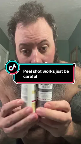 This stuff works just be careful if you have sensitive skin lol.  #tiktokshoprestock #peelshot #acne #facecare #drmelaxinpeelshot 