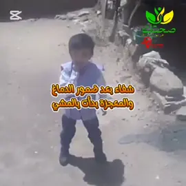 معجزة من رحم الأمل! طفل كان لا يمشي بسبب ضمور الدماغ، لكن بعد الالتزام بالمكملات الطبيعية وتنشيط الخلايا… استعان بالله، واستمر 💪🌿 واليوم يمشي بخطوات الأمل 🙏💫 لا تيأس… فالأمل يصنع المعجزات 🌈 🔹 للاستشارة المجانية: خاص 💬 #صحتك_في_توازن_غذائك #عماد_المحمود #ضمور_الدماغ #حالات_شفاء #امل_جديد #تشافي #DXN #عرف_الاسد #سبيرولينا #الفطر_الريشي #المورنزي #كوكوزي #قصص_ملهمة #مشروعك_مع_عماد_المحمود 