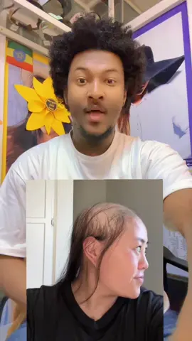 Amazing hair growth treatment #jspbeautyandfation #jspbeautyandfation2 #jspluxurybeautystore #habeshatiktok #viraltiktok 