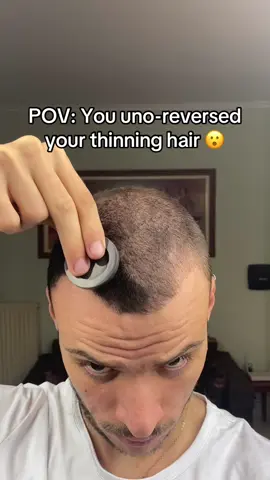 Found the glitch 🫣