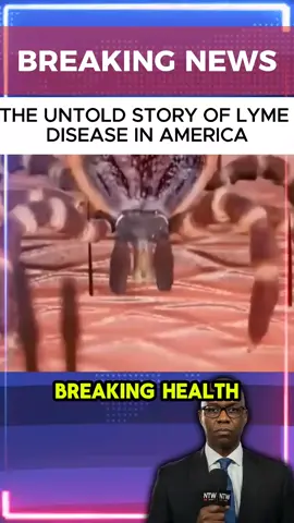 #globalnews #news #breakingnews #tiktoknews #eua 