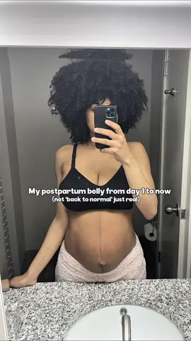 From day 1 postpartum to now… my body’s changed, and so have I. 💪🏾 The stretch marks + loose skin? Not flaws, they’re proof I grew life. 🫶🏾 This body is strong, capable, and worthy of love at every stage. 🥹 #mombod #bodypositivity #fitmom #postpartumbody #fitnessmotivation 