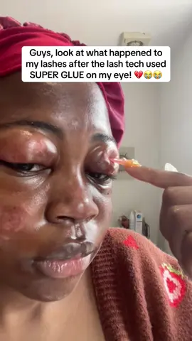 💔😭 #women #salon #girlfriend #hospital #eye 