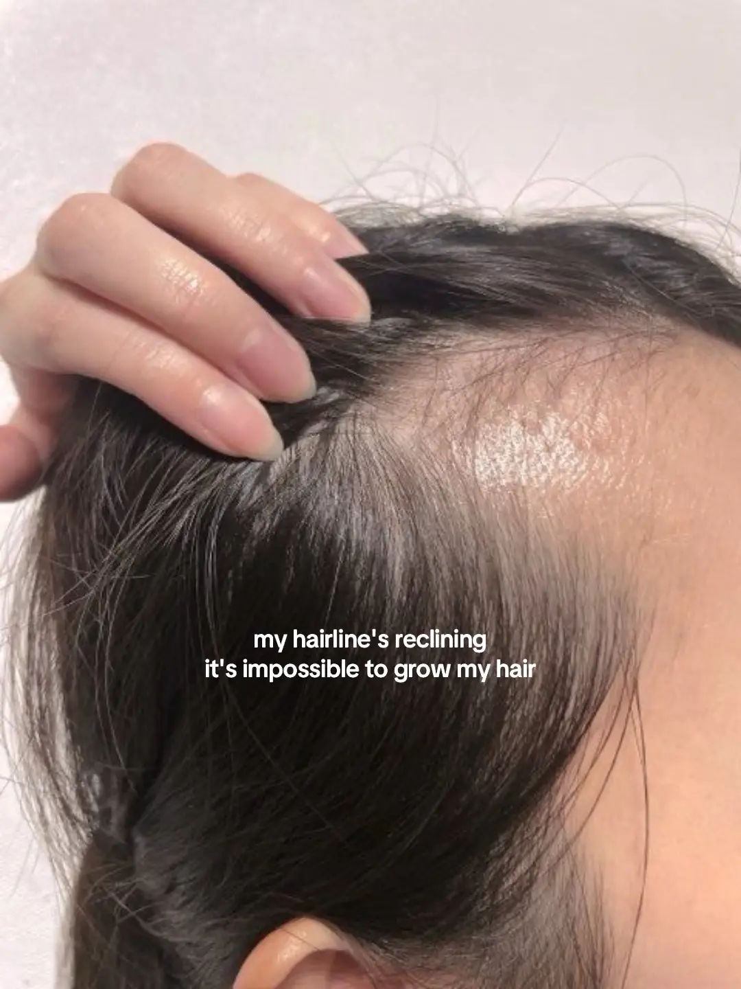 #hairoil #hairgrowth #haircare #hairtok #fyp 
