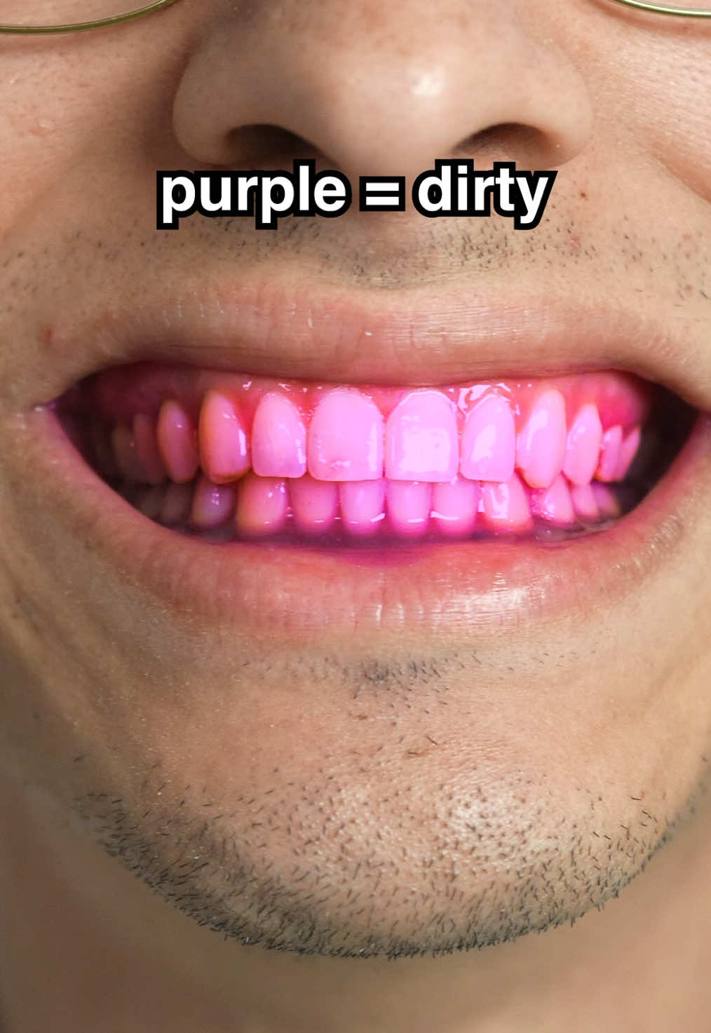 How I get my teeth white 😁 @Puneet Nanda bridge the gap @GuruNanda LLC #gurunanda #transformation #fyp #viral #routine 