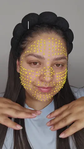✨ Olha esse antes e depois 😱 7 dias com o APRILSKIN Carrotene IPMP Clearing Solution 🥕🌿 Adeus acne, olá pele limpa 💛 ✨ Look at this before & after 😱 7 days with APRILSKIN Carrotene IPMP Clearing Solution 🥕🌿 Goodbye acne, hello clear skin 💛  #APRILSKIN #APRILSKINskincare #carroteneclearingsolution #carrotshots #acnetreatment @APRILSKIN USA 