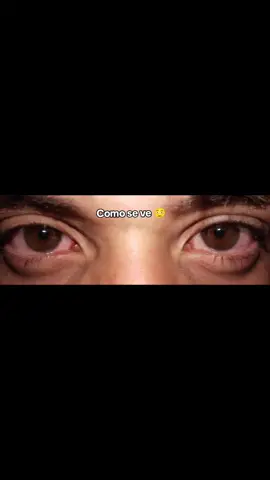 #fypシ゚ #ojosrojos #viraltiktok #viralvideos 🫩😂.!