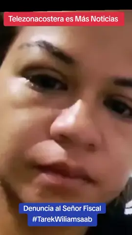 #Telezonacostera #telezonacosteravzla #Carabobo #Valencia #TarekWiliamSaab    Karen Macías, madre de una niña de 6 años, denuncia que en el colegio Mariscal de Ayacucho en Valencia, Carabobo,su hija resultó muy herida. La maestra da diferentes explicaciones de lo sucedido. Sufrió fractura en la nariz y en la mano. Pide ayuda al Fiscal 