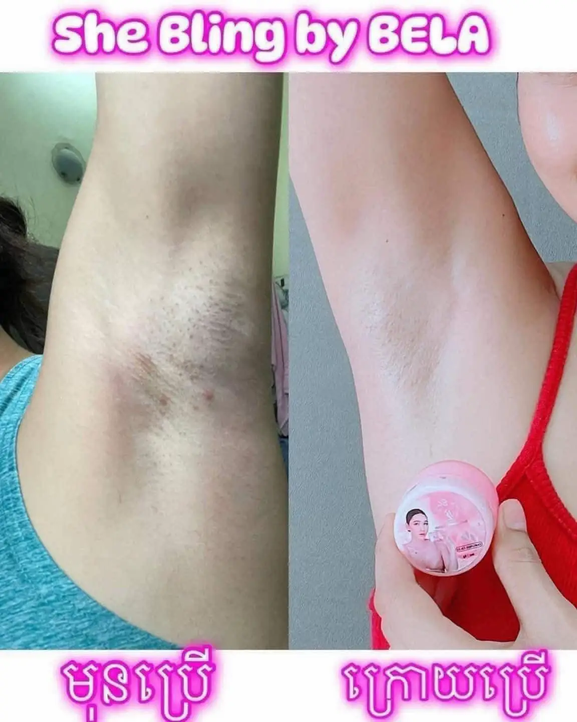 បើចង់បានភាពជឿជាក់ ឡេក្លៀកទឹកអប់ ឡេលាបក្លៀក She Bling by BeLa 🌸🌸🌸 ល្អប្រើខ្លាំង  ជាពិសេសនាក់មានបញ្ហាដូចជា … ក្លិនក្លៀក  ក្លៀកបែកញើស មានសាល ក្លៀកខ្មៅក្រិន មានដុំពក  ក្លៀកបែកសង្វារ ប្រើបាត់រាល់បញ្ហាទាំងនឹងបងអូន 🌸🌸🌸#អីវ៉ាន់ចូលស្តុកហើយបងៗអាចកម្មងបានណាបងៗ📩📩❤️❤️ #foryou #fyp 