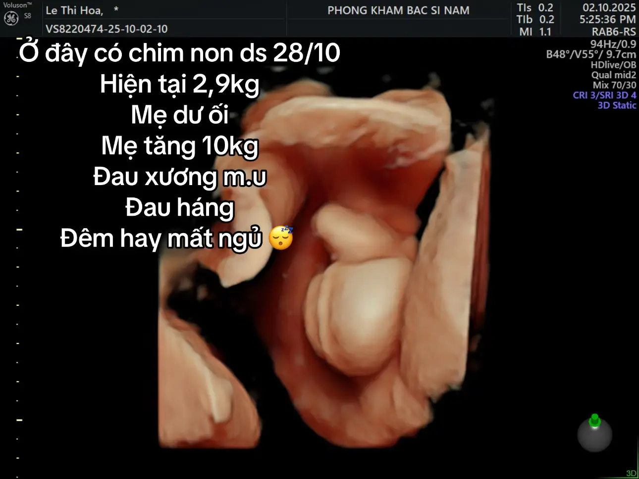 Khum biết đến lúc đẻ con đc nhiêu kí đây 🥰, chúng mình sắp được gặp nhau rùi, hẹn 25 ngày đếm ngược nhớ 😍😍 #mebau #beer #2025 #viabetraidangyeu 