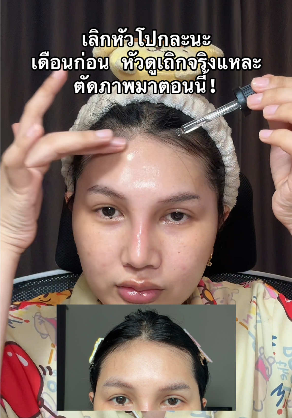 #แฮรโทนิค #แฮร์โทนิคจีเฮิร์บ #จีเฮิร์บ 