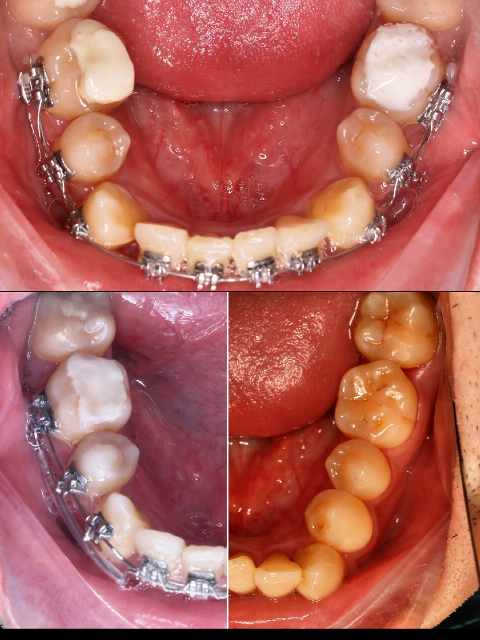 #nhakhoa #răng_miệng #lamdep #răng #rangmieng 