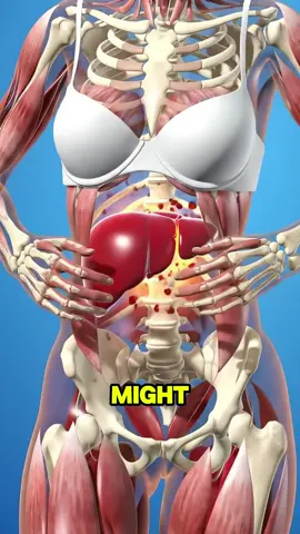 five early signs of liver failure you might not even know about #liverfailure #liver #liverdisease #healthtip #usa_tiktok 