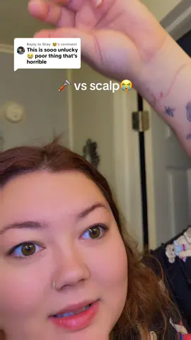 Replying to @Shay 🥸 yea.. #cut #scar #hairfail #uh #fyp