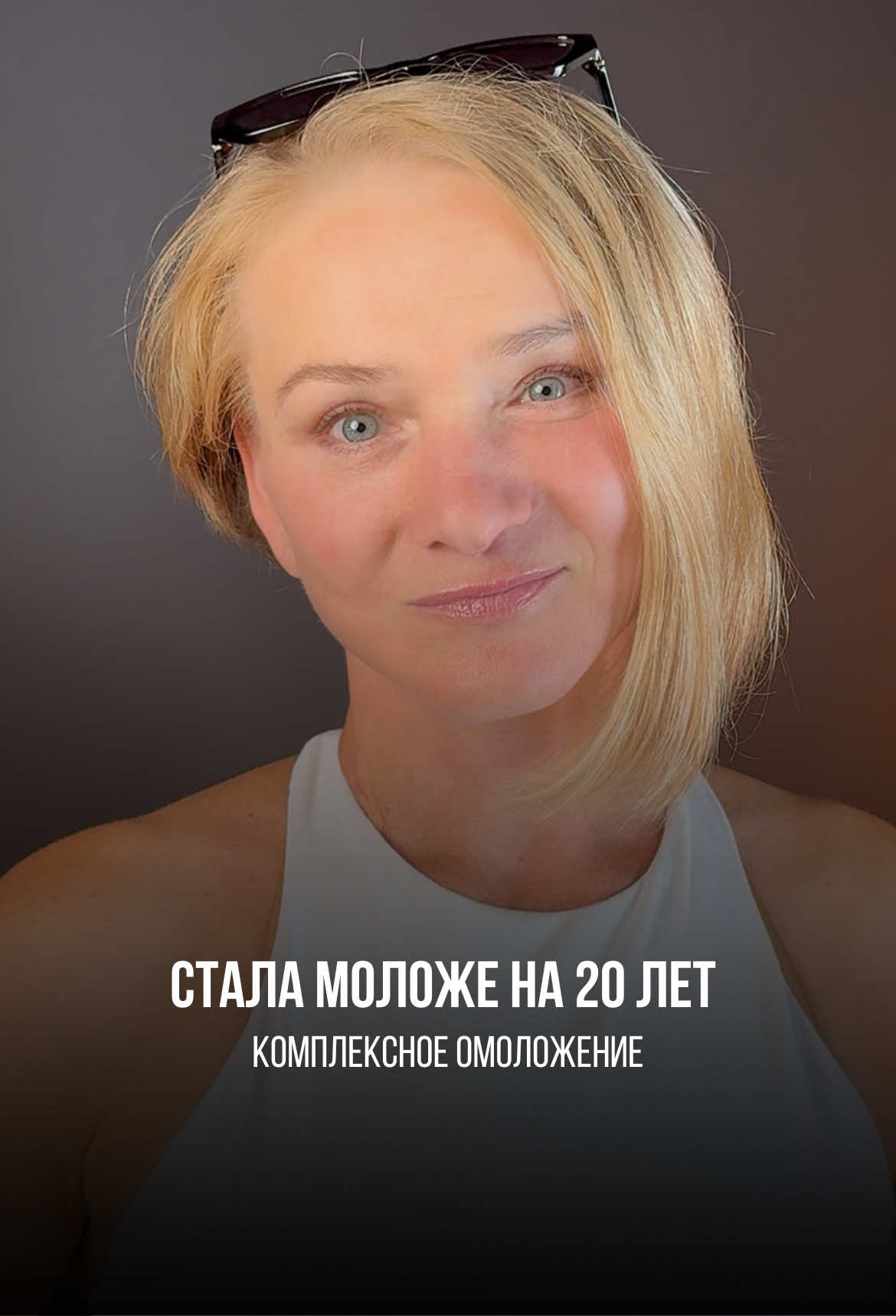 #пластическаяхирургияказахстан #блефаропластика #омоложениелица #smas 