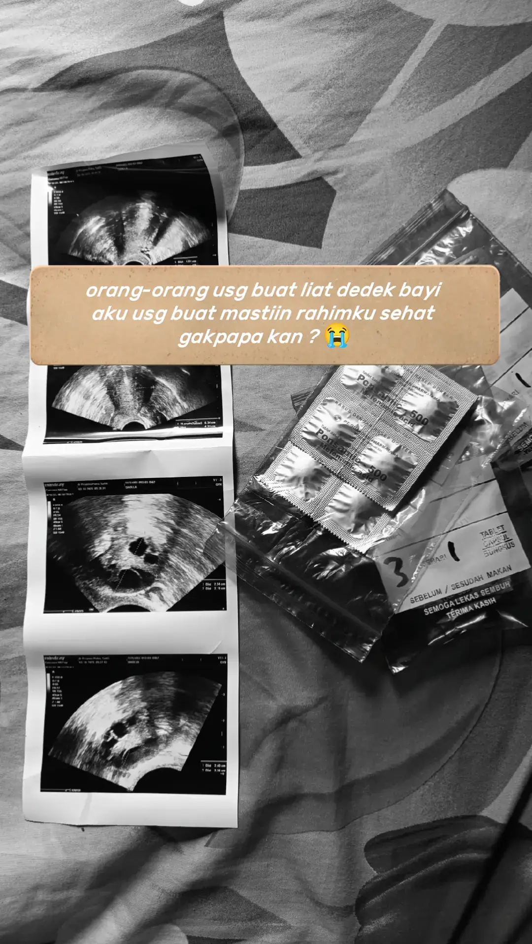 gak apa apakan 😭 #pcos #pejuanggarisdua #lewatberanda 