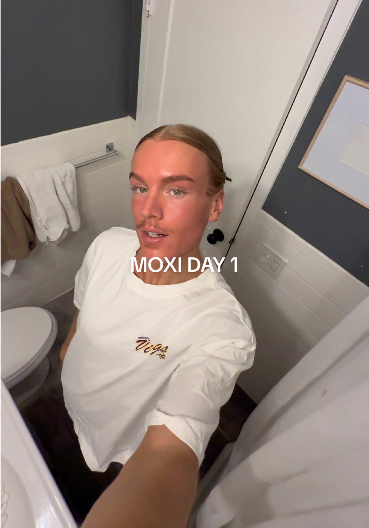 Moxi Laser🧖🏻 posting daily updates on this treatment to see how much my skin improves! #fyp #moxilaser #laserie #edina #daily 