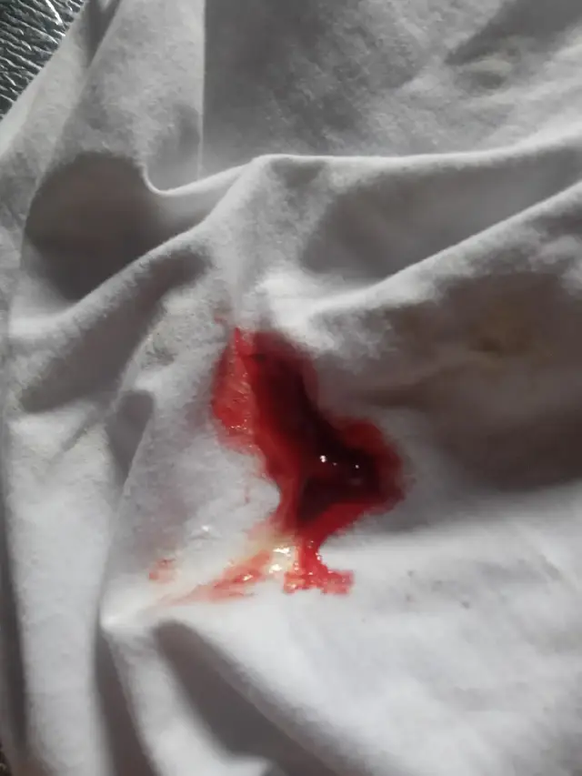 sana walang mangyareng masama sayo anak nagdudugo at nagsusuka nako ng dugo ank