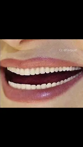 😂😂😂#foryou#fyp 