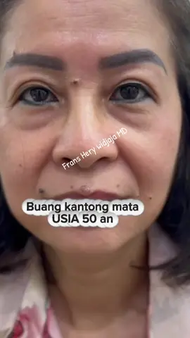 #buangkantongmatajakarta #buangkantongmatabali #buangkantongmatasurabaya #buangkantongmatabatam#CapCut 