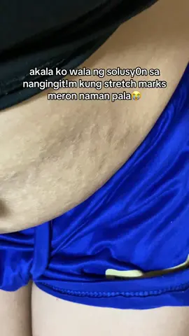 nangingit!m na stretch marks ngay0n nag lalighten na😭 #stretchmarks #stretchmarkremoval #stretchmarkoil #organicskinbeautyoil 