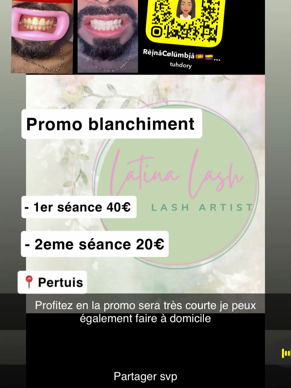 #blanchimentdentaire #pertuis #promo #sourirecolgate #blanqueamientodental 